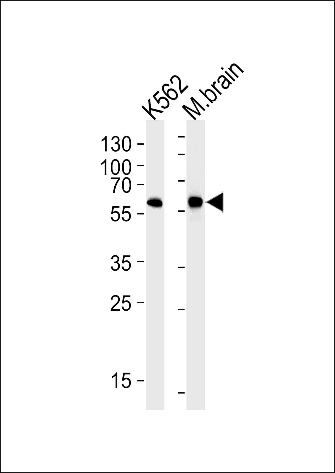 BAIAP2 / IRSP53 Antibody (clone 1037CT15.1.3)