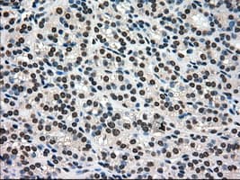 Monoclonal Mouse anti-Human PMEL / SILV / gp100 Antibody (clone OTI10E5, IHC, IF, WB)