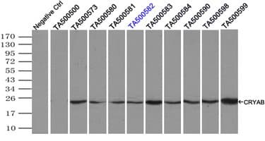 IHC-plus™ CRYAB / Alpha B Crystallin Antibody (clone 4A6)