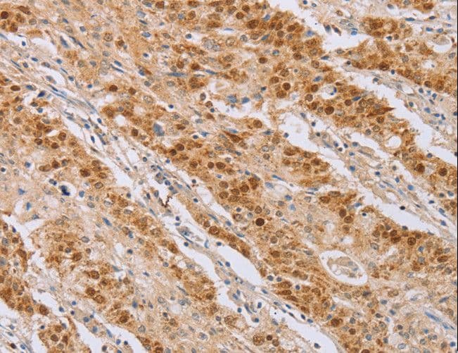 MCM5 Antibody