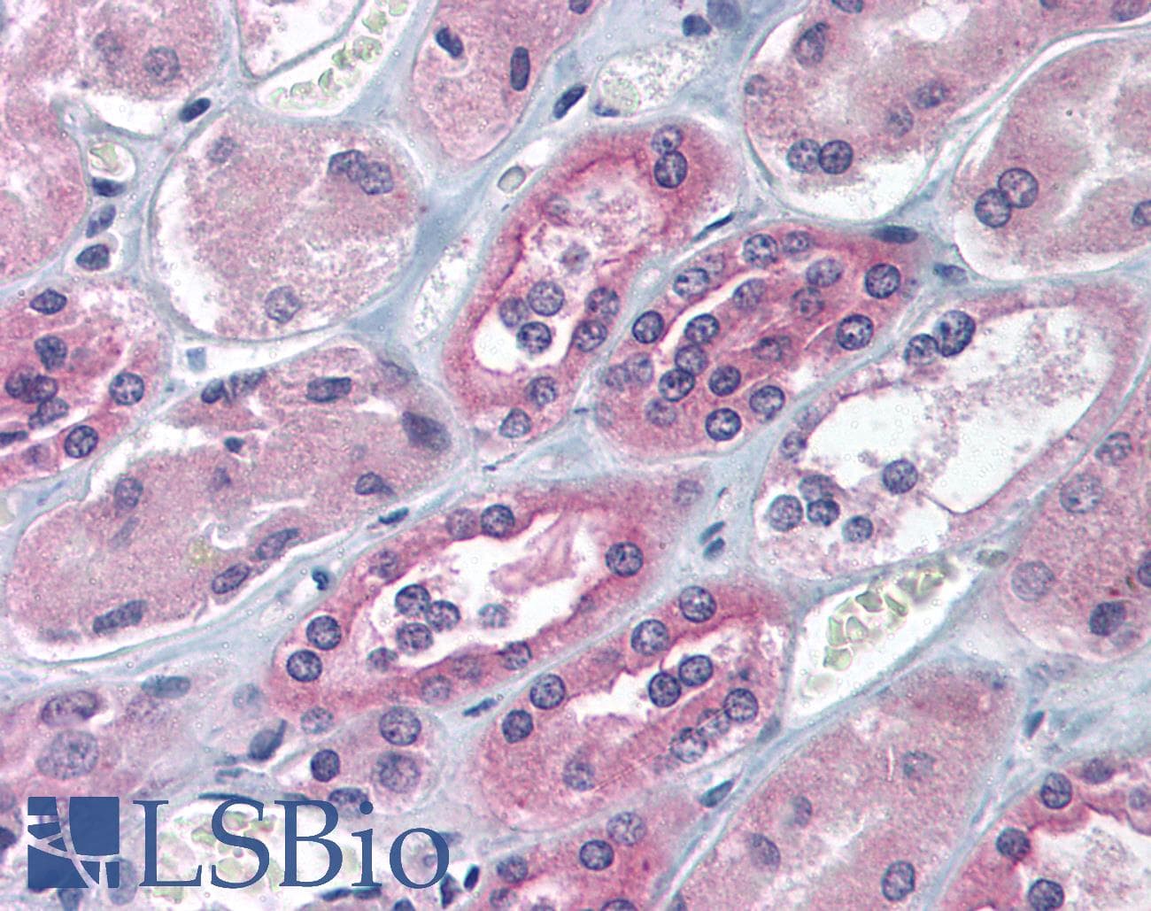 CRD-BP / ZBP1 / IGF2BP1 Antibody (aa155-204)