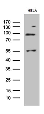 Monoclonal Mouse anti-Human MLH1 Antibody (clone OTI6E8, aa1-298, WB)