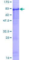 Human PI16 Protein (Recombinant GST)