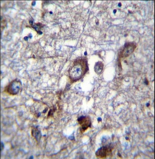 PLEKHH1 Antibody (aa1082-1110)