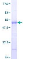 Human ARHGDIG / RHOGDI-3 Protein (Recombinant GST)