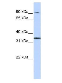 Polyclonal Rabbit anti-Human ZFP90 Antibody (aa54-85, WB)