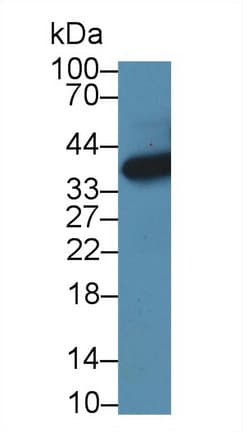 HIBCH Antibody