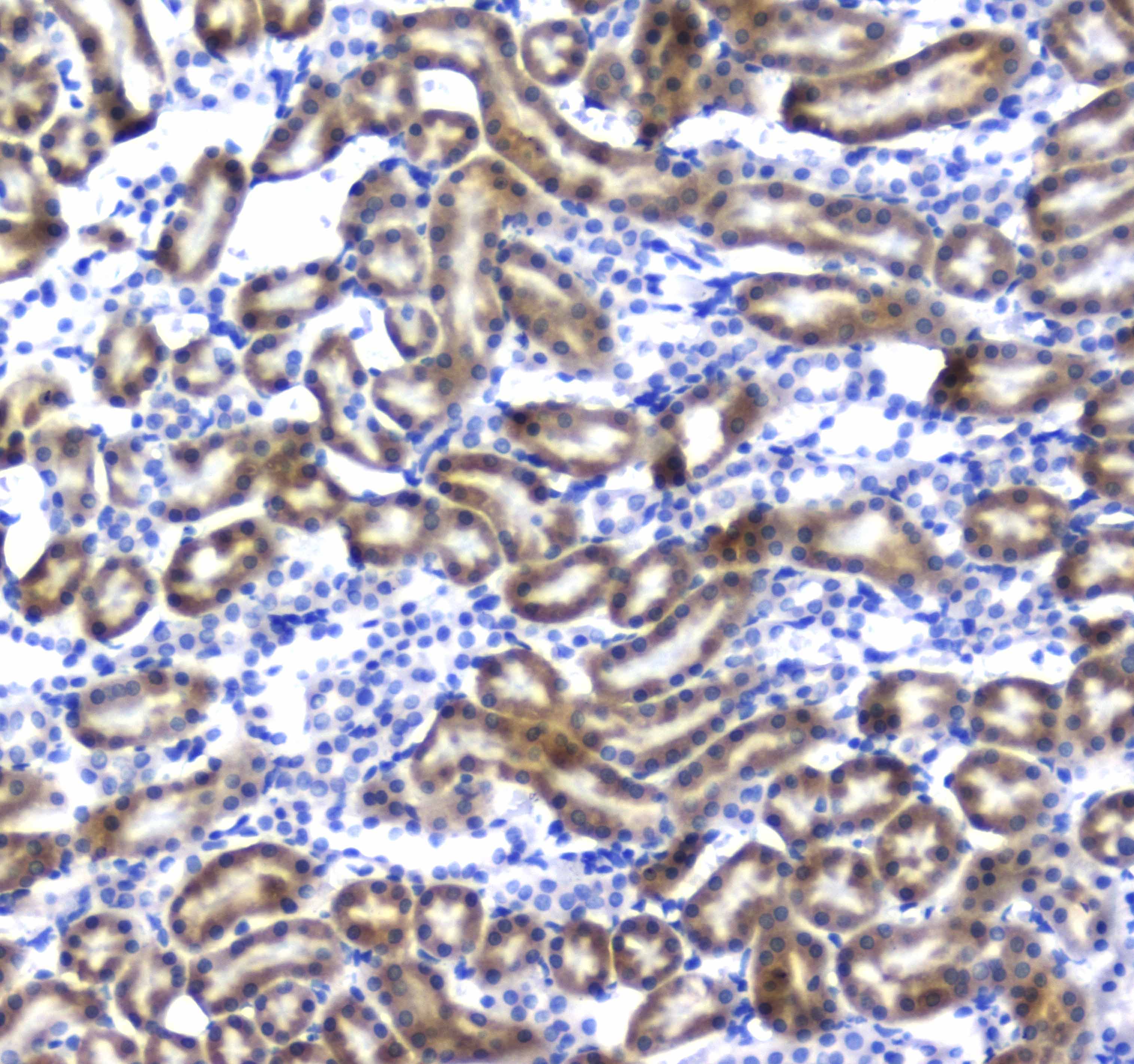 Polyclonal Rabbit anti-Human RGN / Regucalcin Antibody (IHC, WB)