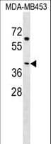 EFCBP2 / NECAB2 Antibody (aa1-30)