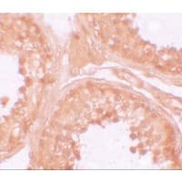 NLRP9 Antibody