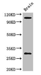 EPHA1 / EPH Receptor A1 Antibody