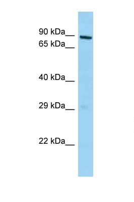 Polyclonal Rabbit anti-Mouse MPHOSPH10 / MPP10 Antibody (aa444-493, WB)