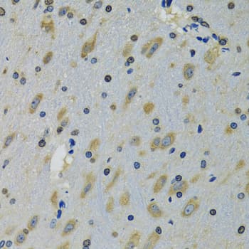 Polyclonal Rabbit anti-Human RPS12 / Ribosomal Protein S12 Antibody (IHC, IF, WB)