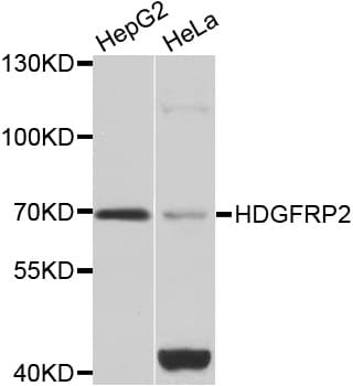 Polyclonal Rabbit anti-Human HDGFRP2 Antibody (IHC, IF, WB)