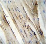 FUT4 / CD15 Antibody (aa495-524)