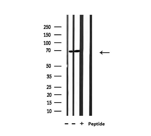 Polyclonal Rabbit anti-Human NXF1 / TAP Antibody (IF, WB)