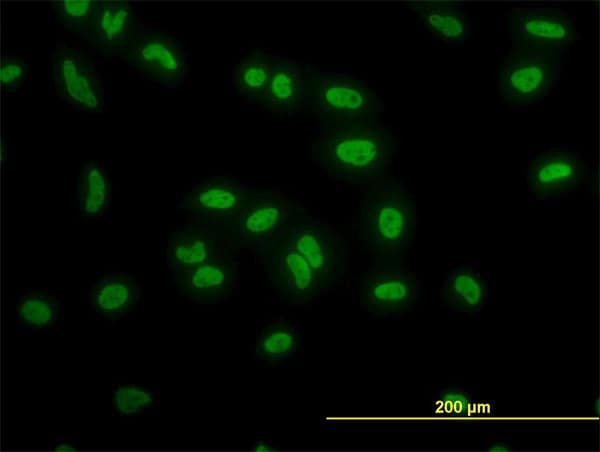 TAF11 Antibody (clone 3H5)