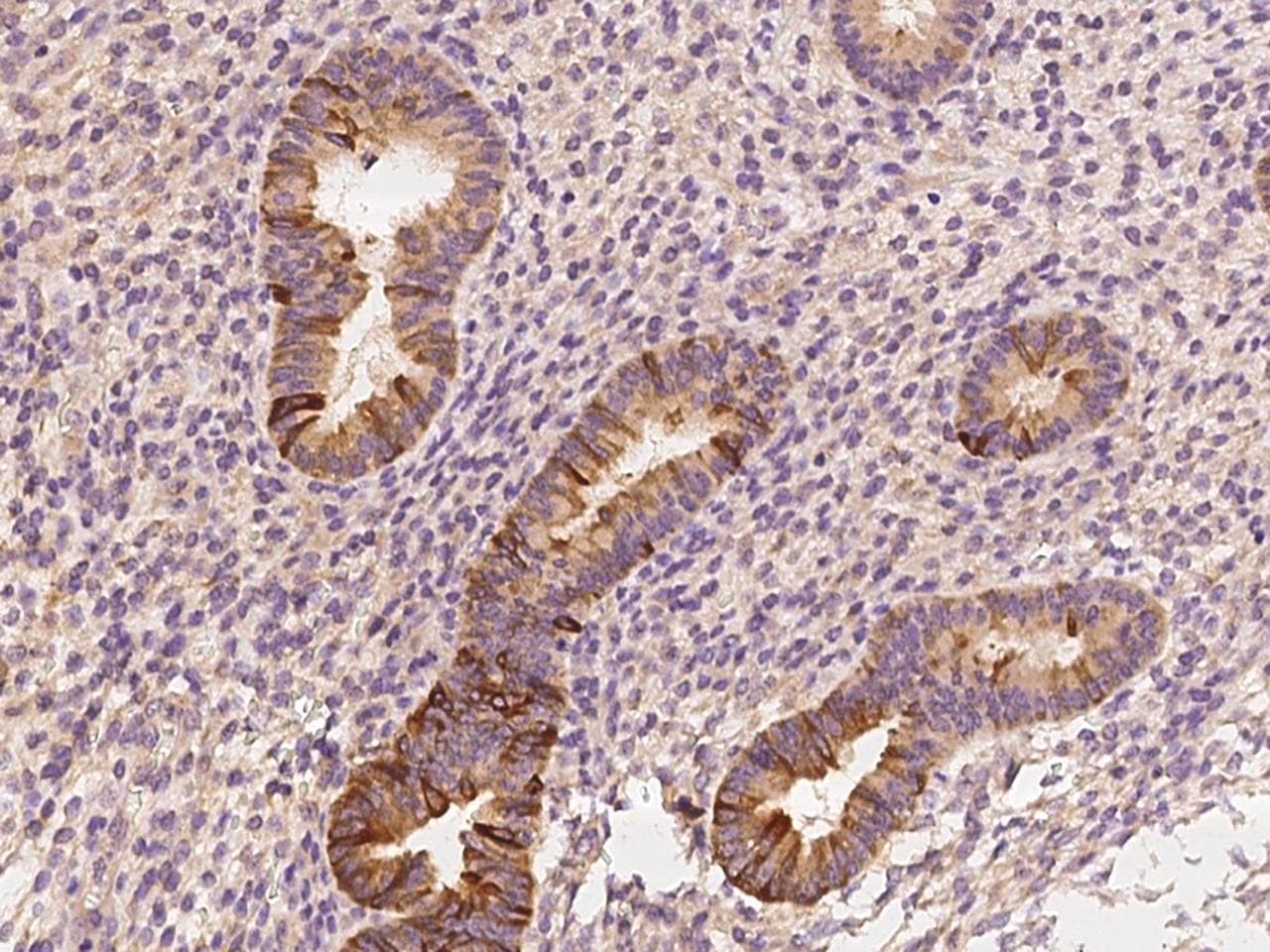 Polyclonal Rabbit anti-Human SCGB2A1 / Mammaglobin B Antibody (IHC)