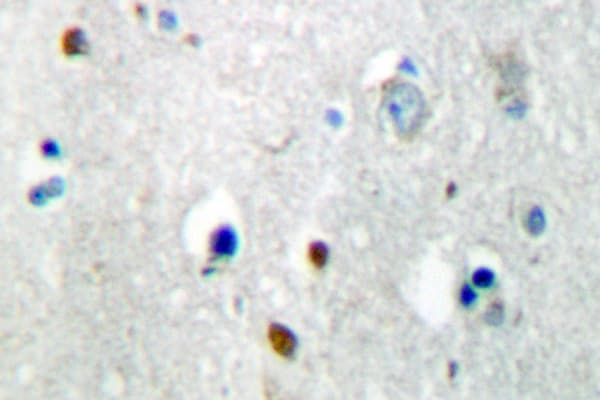 DUSP4 / MKP2 Antibody (Tyr108)