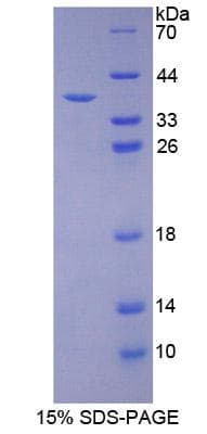 Mouse CD274 / B7-H1 / PD-L1 Protein (Recombinant His-T7)
