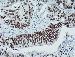 TP53 / p53 Antibody (clone OTI5E2)