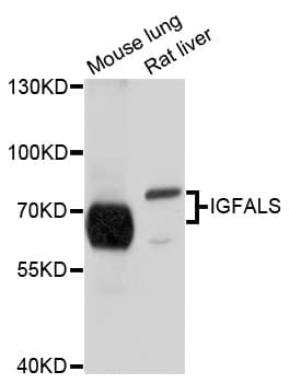 Polyclonal Rabbit anti-Human IGFALS / ALS Antibody (WB)