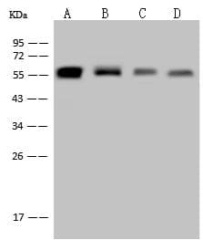 Vimentin Antibody (clone 001, Preservative Free)