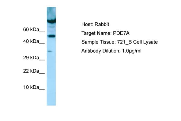 PDE7A Antibody (aa338-387)