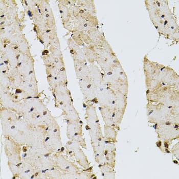 Polyclonal Rabbit anti-Human PPP2R5C Antibody (IHC, WB)
