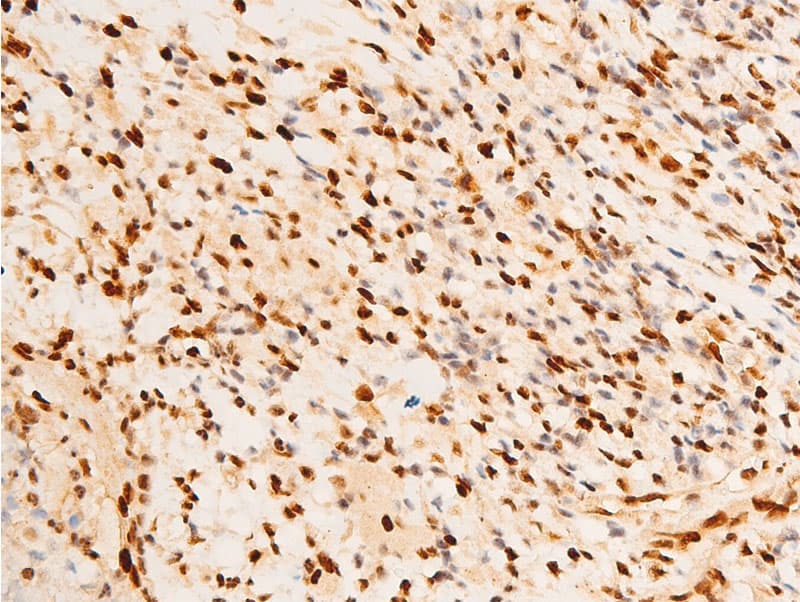 JUN / c-Jun Antibody (phospho-Ser243)