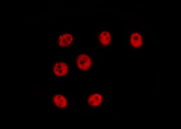 Polyclonal Rabbit anti-Human ZNF638 Antibody (IHC, IF, WB)