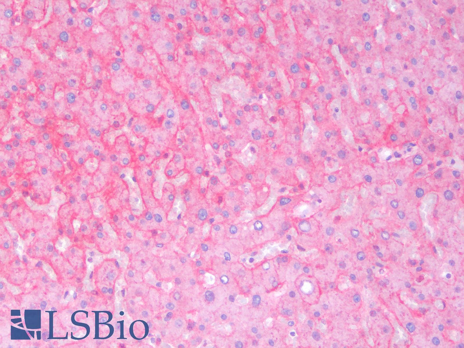 PathPlus™ Polyclonal Rabbit anti-Human KRAS Antibody (IHC)