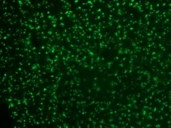 NCL / Nucleolin Antibody (clone 364-5, Ready-to-Use)