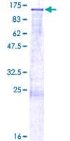 Human DGCR8 Protein (Recombinant GST)