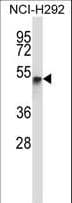 Polyclonal Rabbit anti-Human RANBP3L Antibody (aa137-165, IHC, WB)