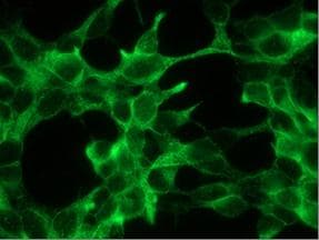 Monoclonal Mouse anti-Human FOLH1 / PSMA Antibody (clone 107.1A4, IHC)
