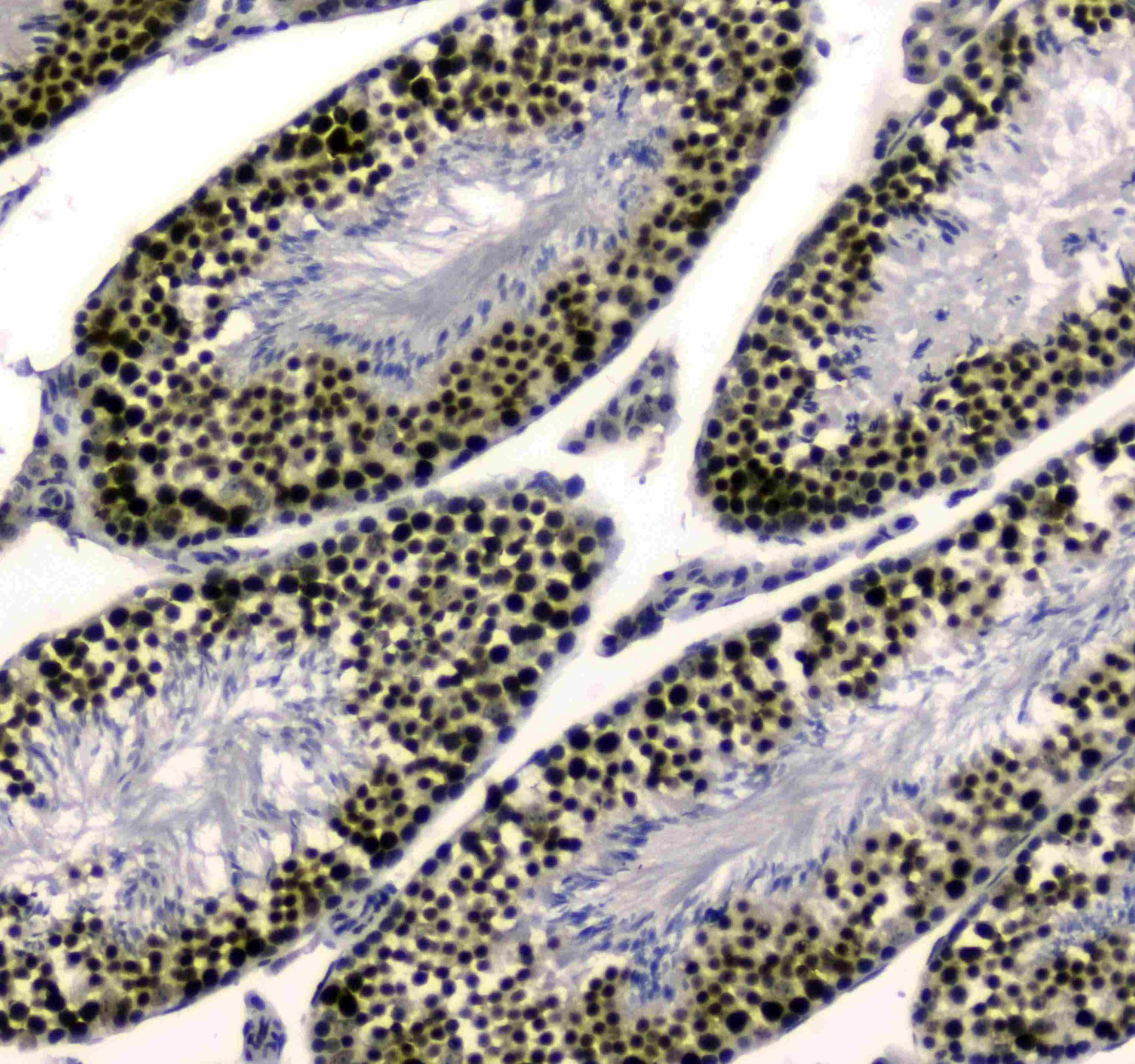 SAE2 / UBA2 Antibody