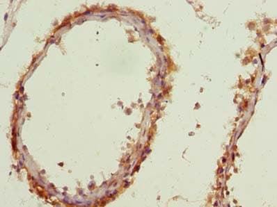 AP4B1 Antibody