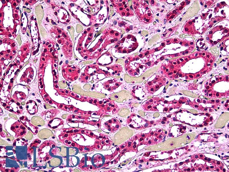 IHC-plus™ ACP2 / Acid Phosphatase 2 Antibody (clone M1-4A12)