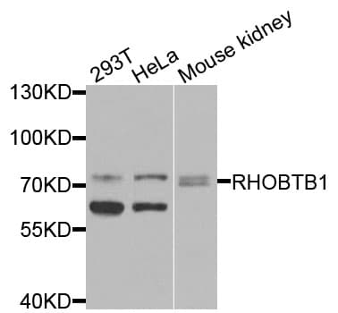 Polyclonal Rabbit anti-Human RHOBTB1 Antibody (WB)