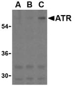 ANTXR1 / TEM8 Antibody