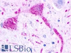 PathPlus™ GPR68 / OGR1 Antibody (Extracellular Domain)