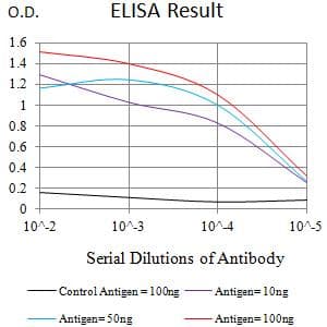 IL5RA / CD125 Antibody (clone 5E12F5D6)