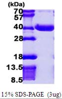 Human NPL / C112 Protein (Recombinant His)