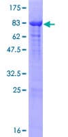 Human RNF25 Protein (Recombinant GST)