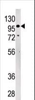 LLGL2 Antibody (aa165-199)