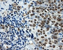 Monoclonal Mouse anti-Human LOX / Lysyl Oxidase Antibody (clone OTI6B11, IHC, IF, WB)