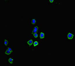 OSM / Oncostatin M Antibody