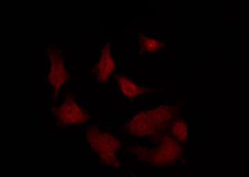 RGS12 Antibody