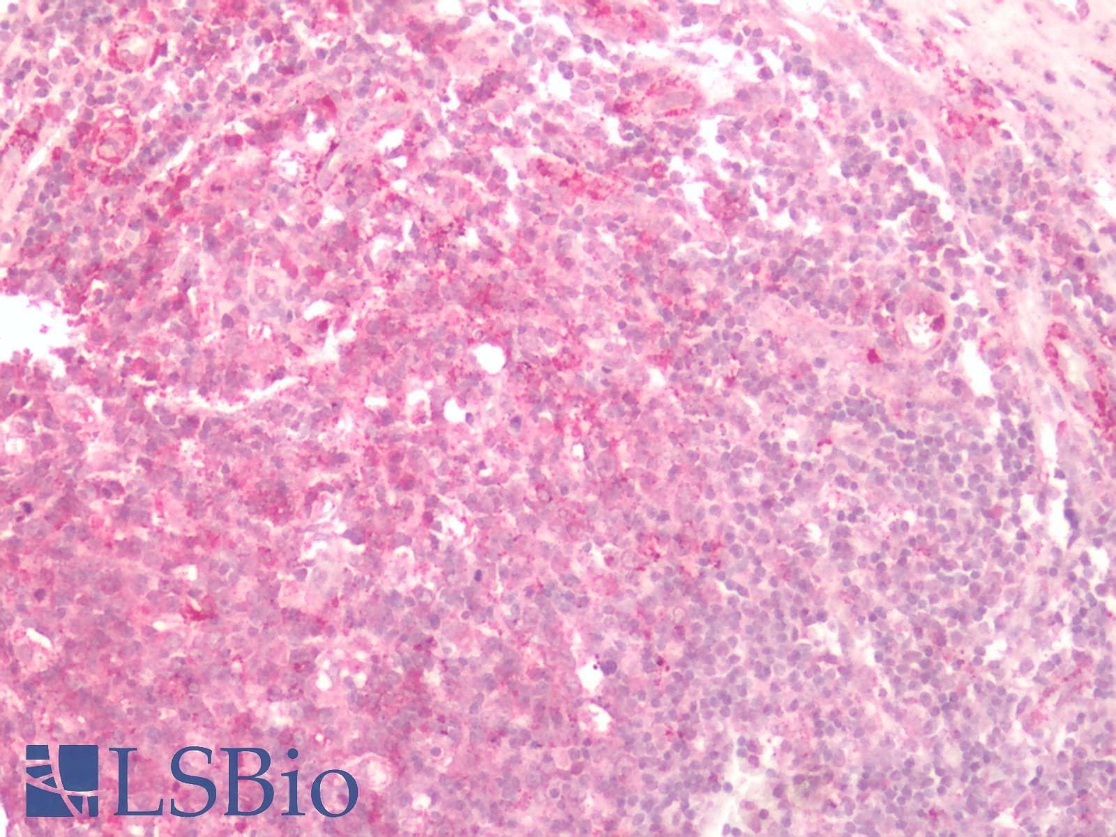 IHC-plus™ Polyclonal Rabbit anti-Human FZD2 / Frizzled 2 Antibody (N-Terminus, IHC)